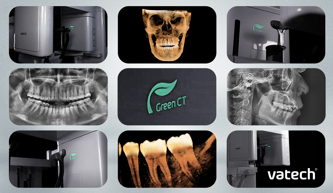 tecnologia green radiologia odontológica